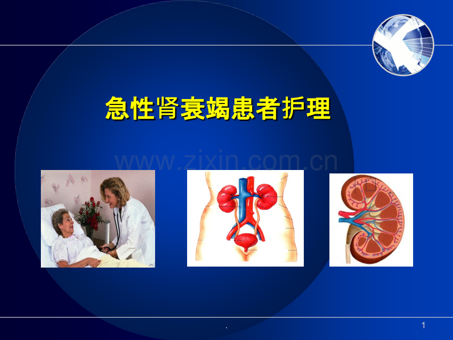 泌尿-急性肾功能衰竭病人的护理.ppt_第1页