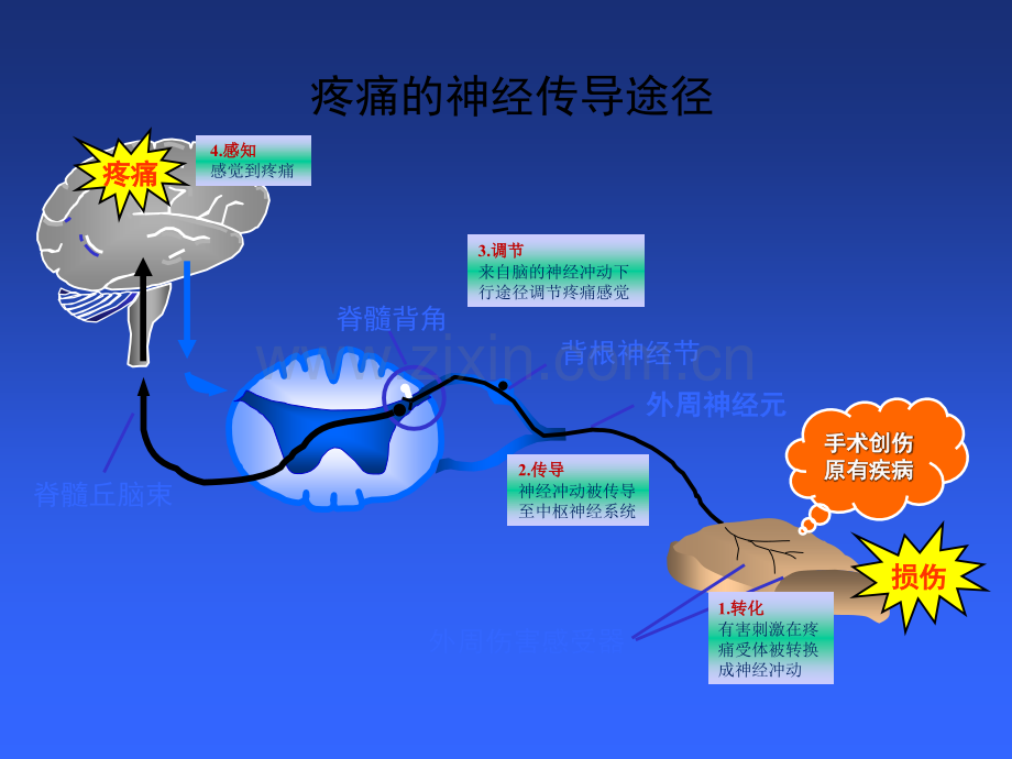 浅谈“多学科协作的多模式镇痛(PMDT)”.ppt_第3页