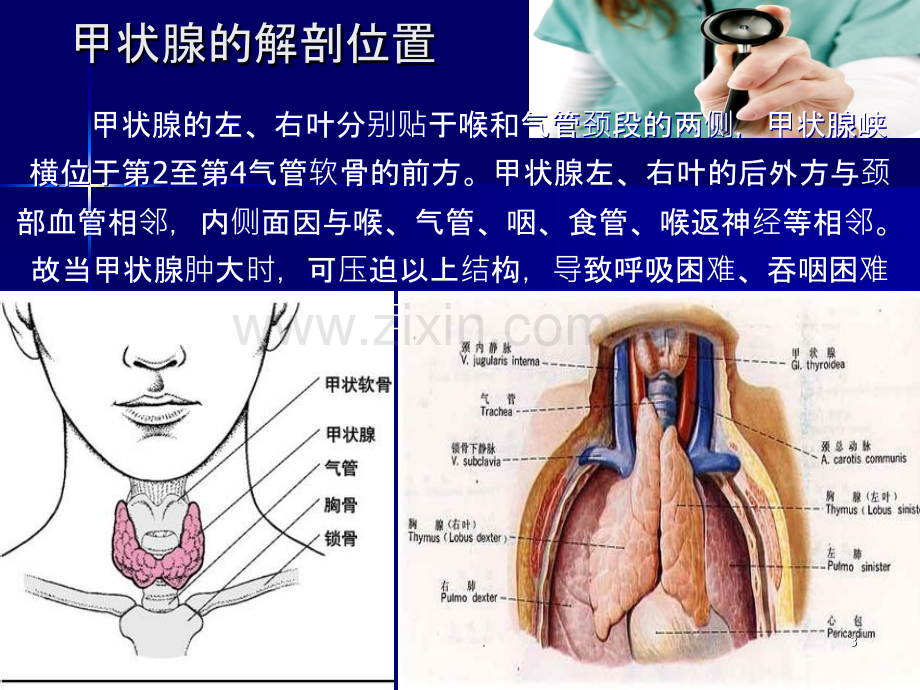 甲状腺癌术后护理.ppt_第3页