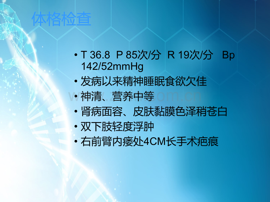 糖尿病肾病血透患者护理查房.ppt_第3页