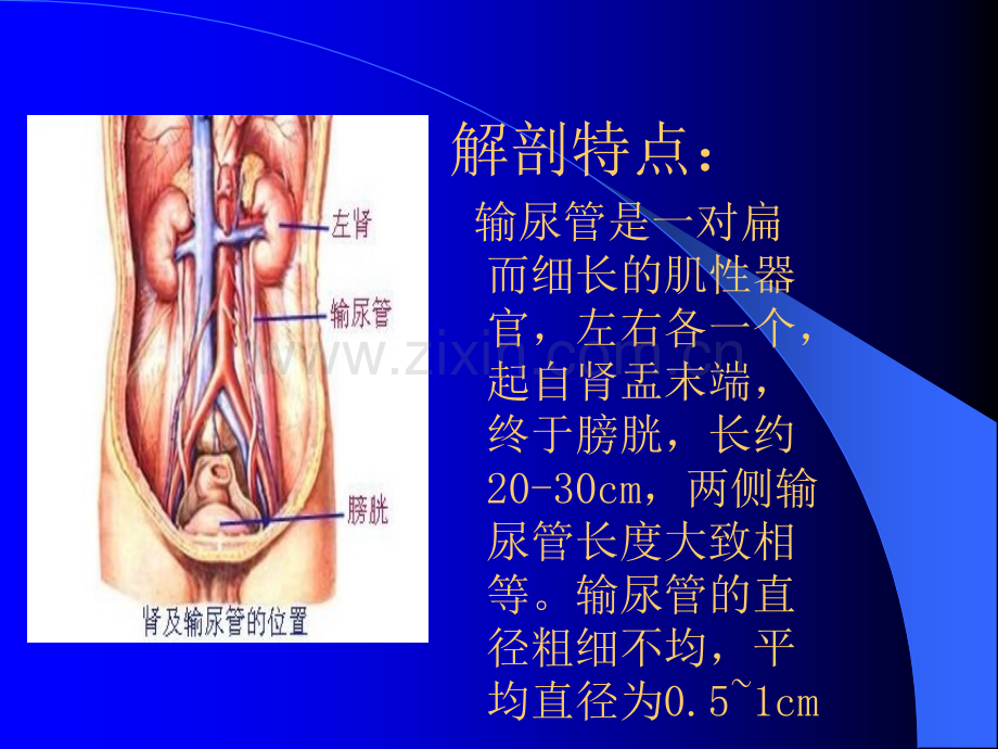 泌尿系结石及护理ppt课件.ppt_第3页