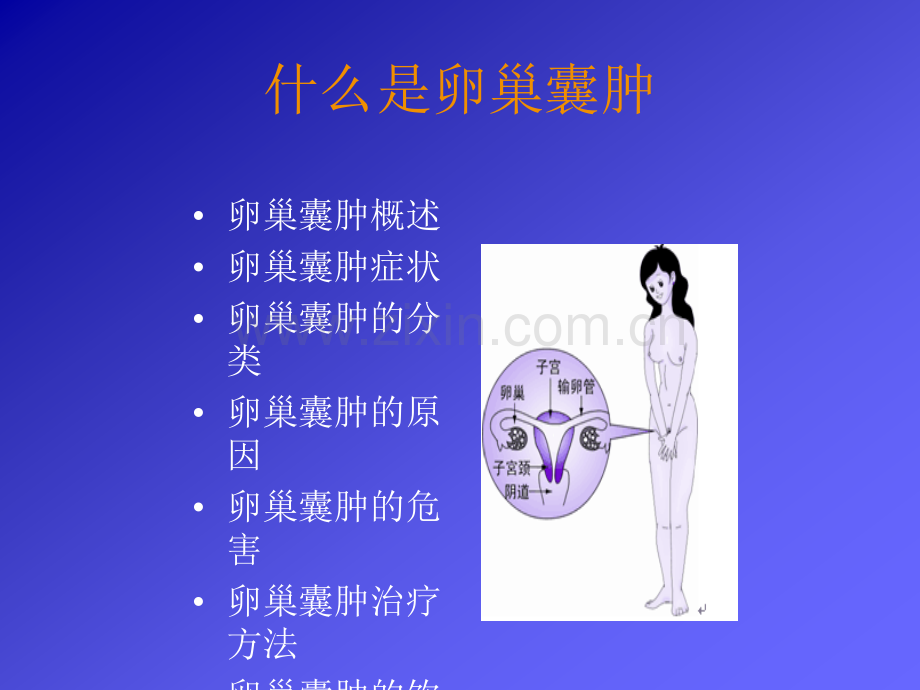 讲卵巢囊肿.ppt_第3页