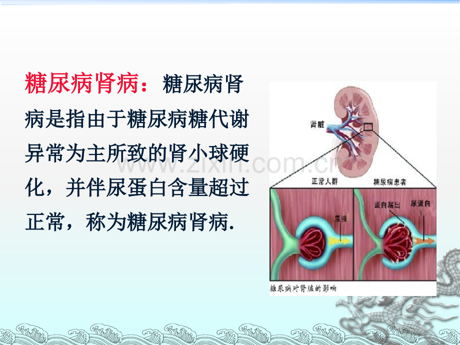 糖尿病肾病病人的护理.ppt_第2页