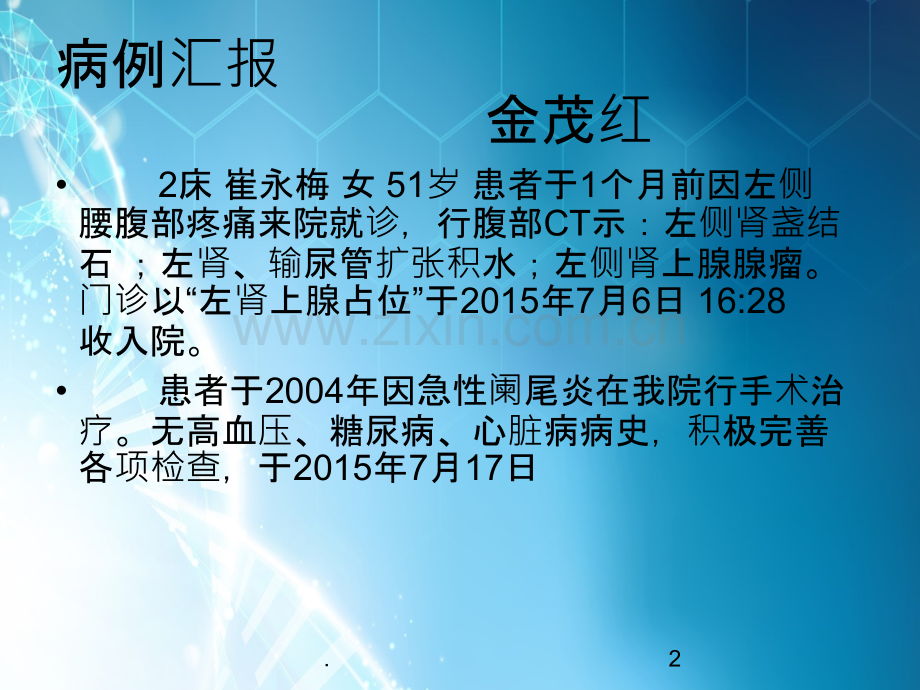 肾上腺瘤护理查房.ppt_第2页