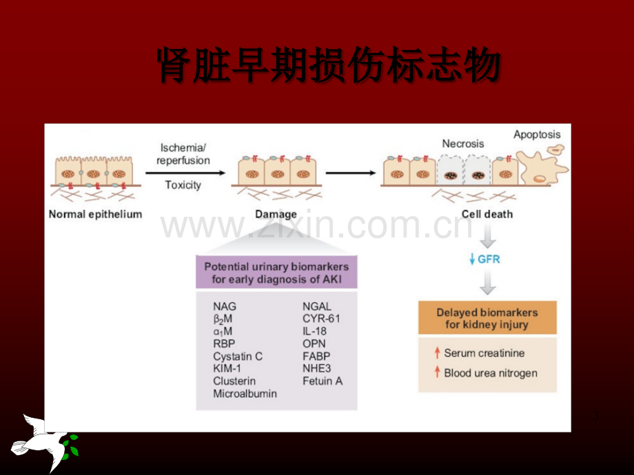 肾损伤早期标志物.ppt_第3页