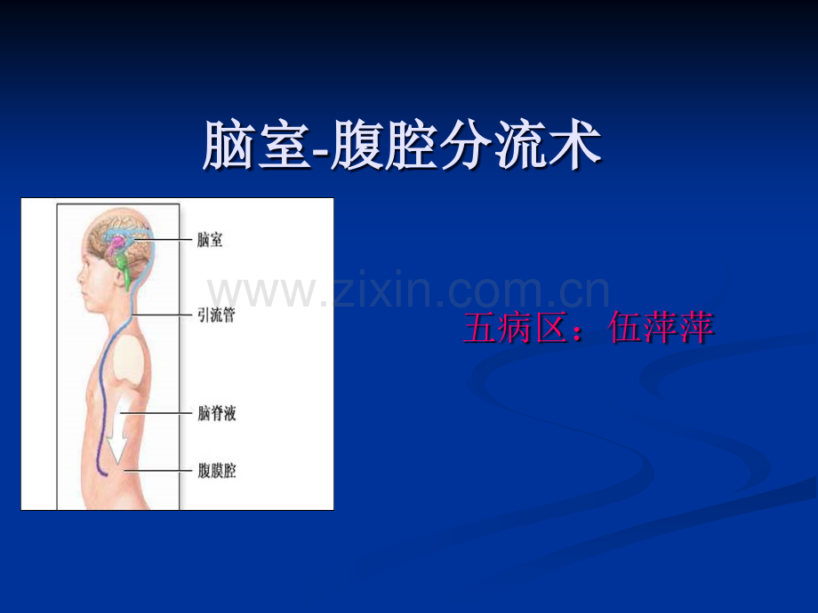 脑室-腹腔分流术.ppt_第1页