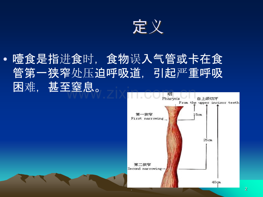 精神病人噎食护理.ppt_第2页