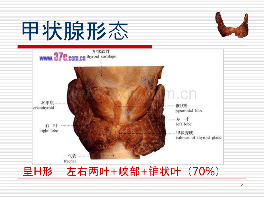 甲状腺肿瘤的护理培训.ppt_第3页