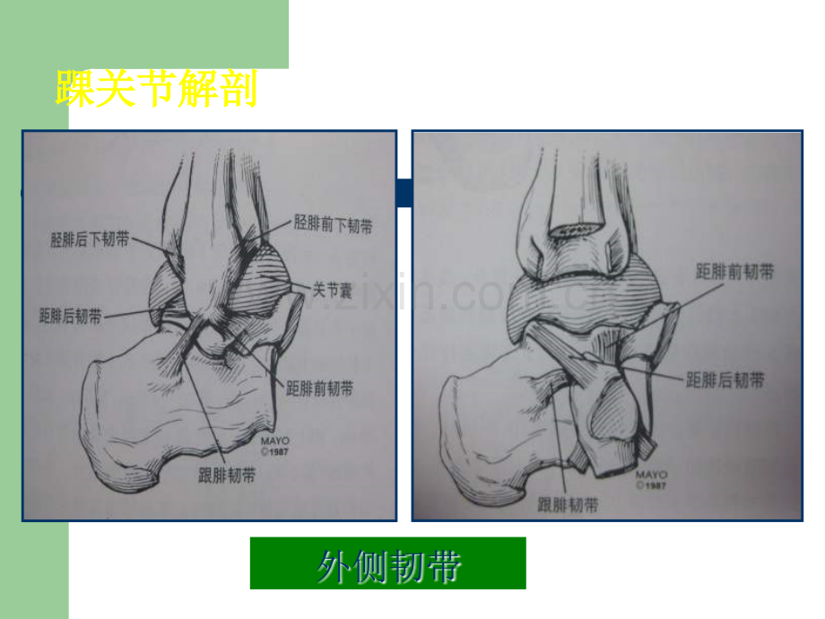 踝关节影像诊断.ppt_第3页