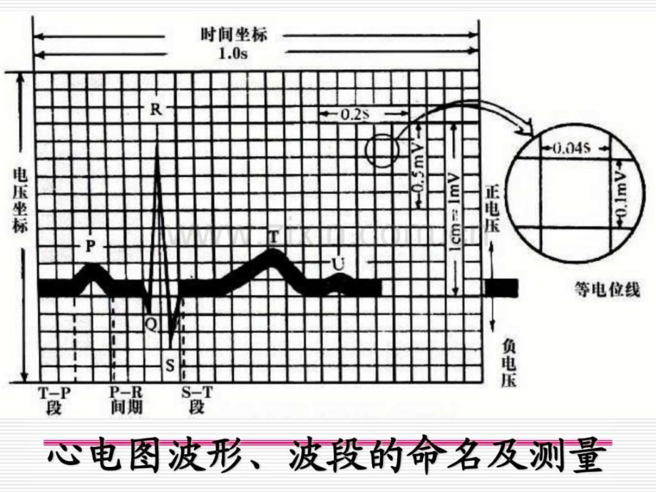 异常心电图图谱汇总1674962919.pptx_第3页