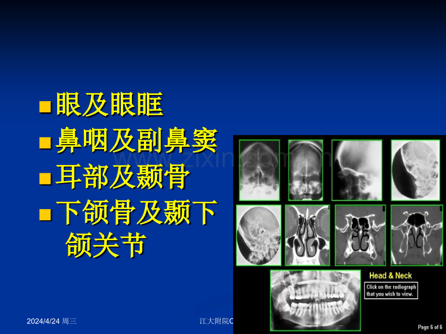 临床医学颜面部影像解剖学.pptx_第2页