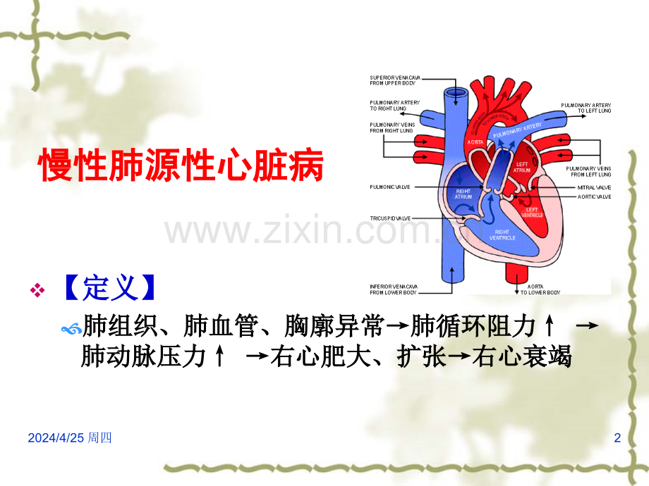 儿科学笔记——慢性肺源性心脏病.pptx_第2页
