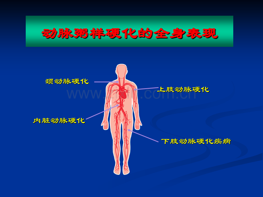 下肢动脉硬化闭塞症介入治疗.pptx_第3页