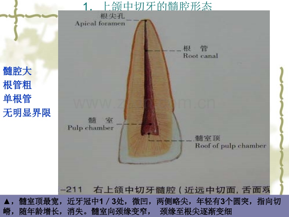 牙髓腔解剖切牙尖牙前磨牙.pptx_第3页