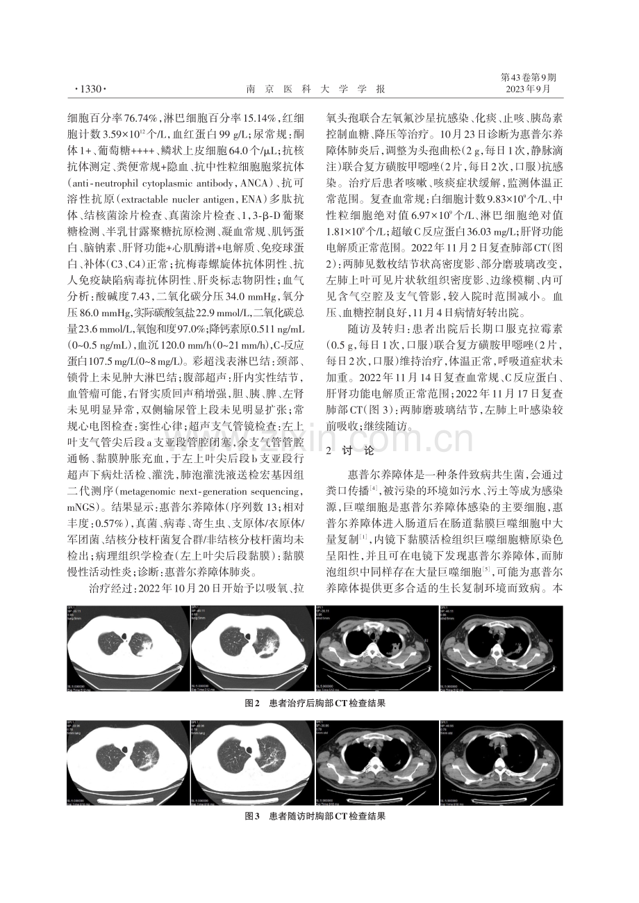 肺泡灌洗液宏基因组学测序诊断惠普尔养障体致肺炎伴肺脓肿1例.pdf_第2页