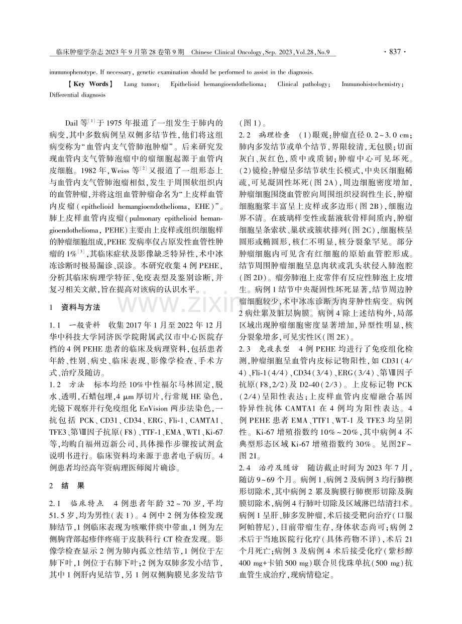 肺上皮样血管内皮瘤4例临床病理观察.pdf_第2页