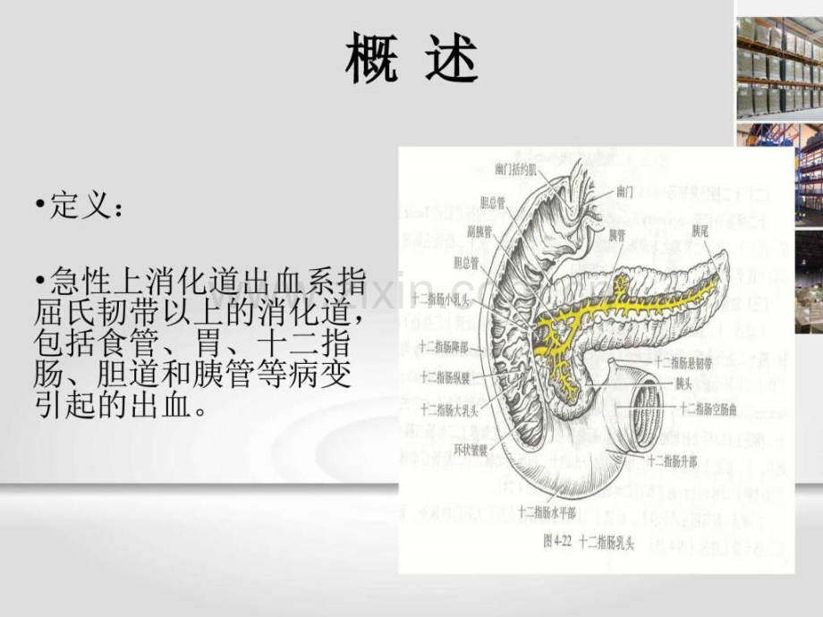 急性上消化道出血急诊诊治专家共识.pptx_第2页