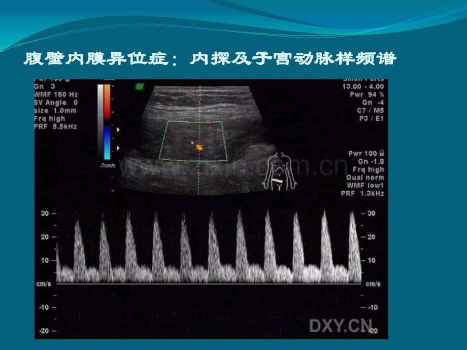 超声笔记.pptx_第3页