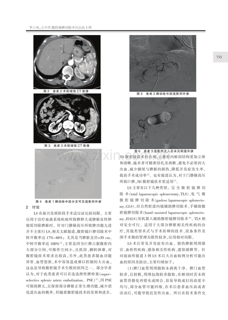 腹腔镜脾切除术后出血3例.pdf_第2页