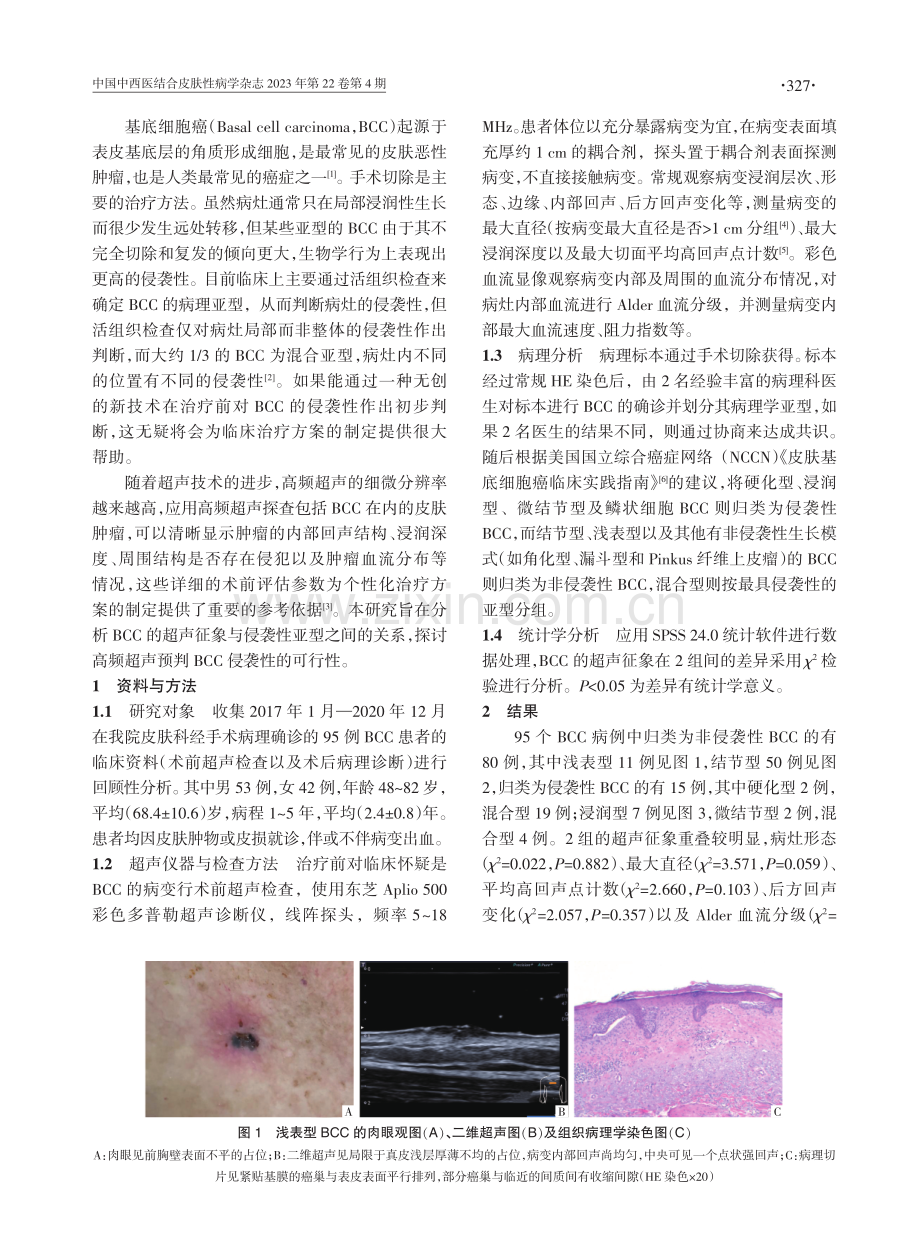 高频超声鉴别侵袭性与非侵袭性皮肤基底细胞癌的应用价值.pdf_第2页