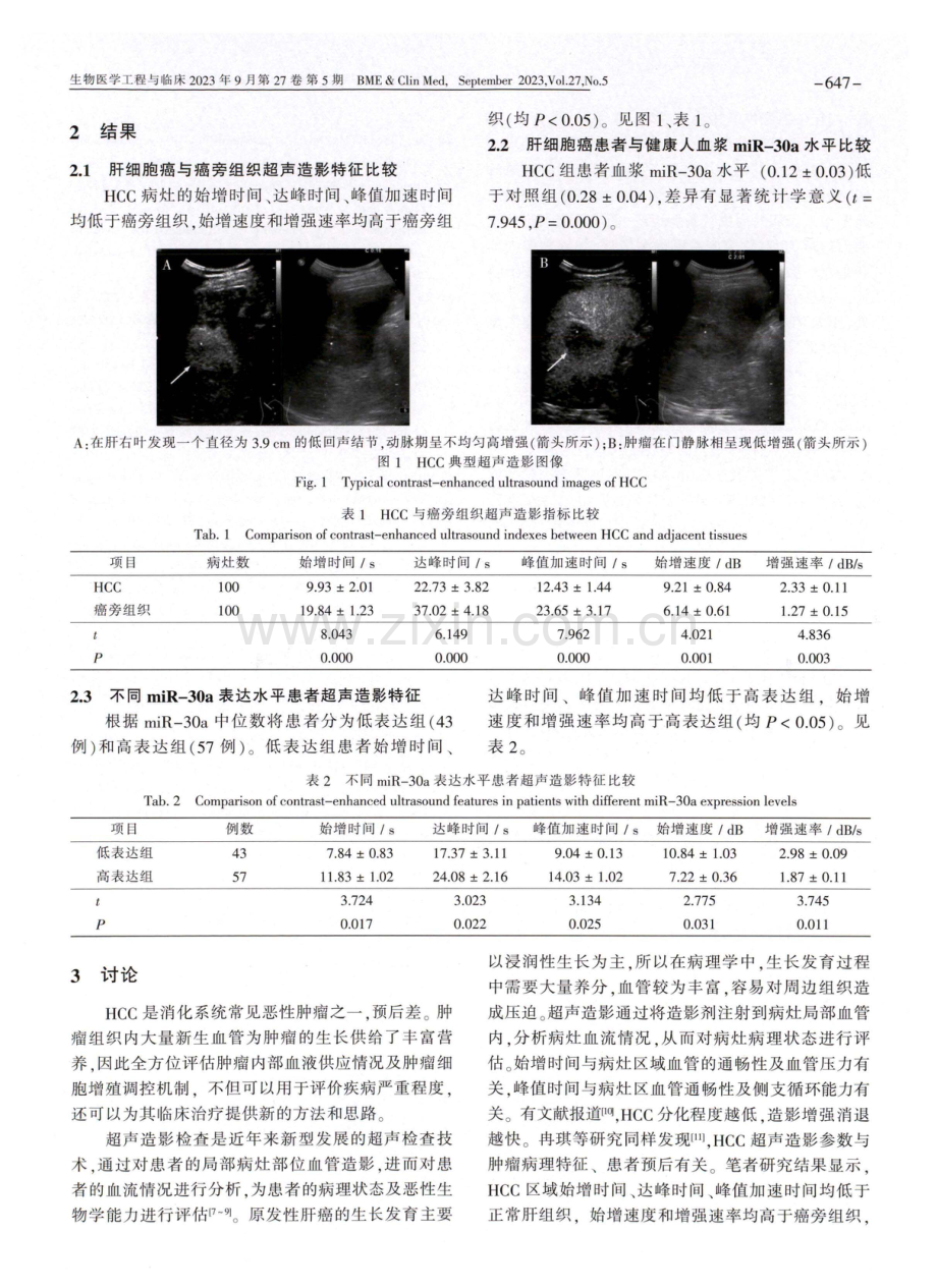 肝细胞癌患者超声造影特征与其血浆miR-30a水平的相关性研究.pdf_第3页