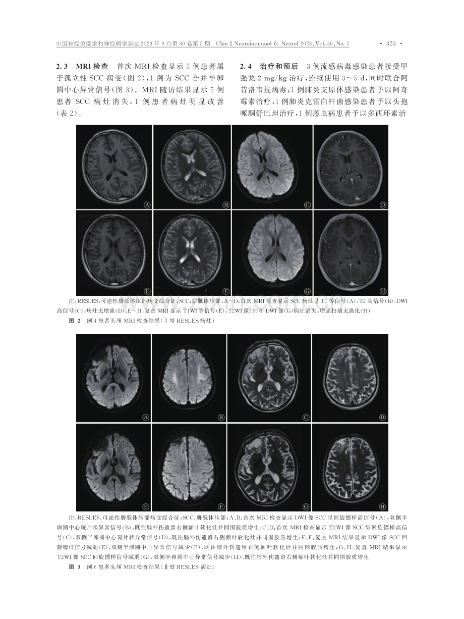 感染继发的可逆性胼胝体压部病变综合征患者临床特征分析.pdf_第3页