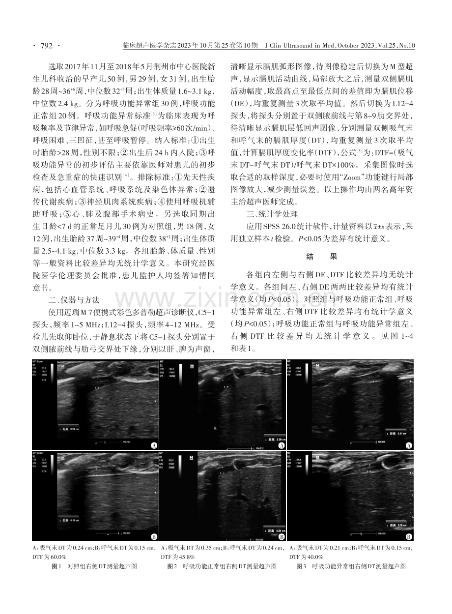 膈肌超声评估早产儿呼吸功能的应用价值.pdf_第2页