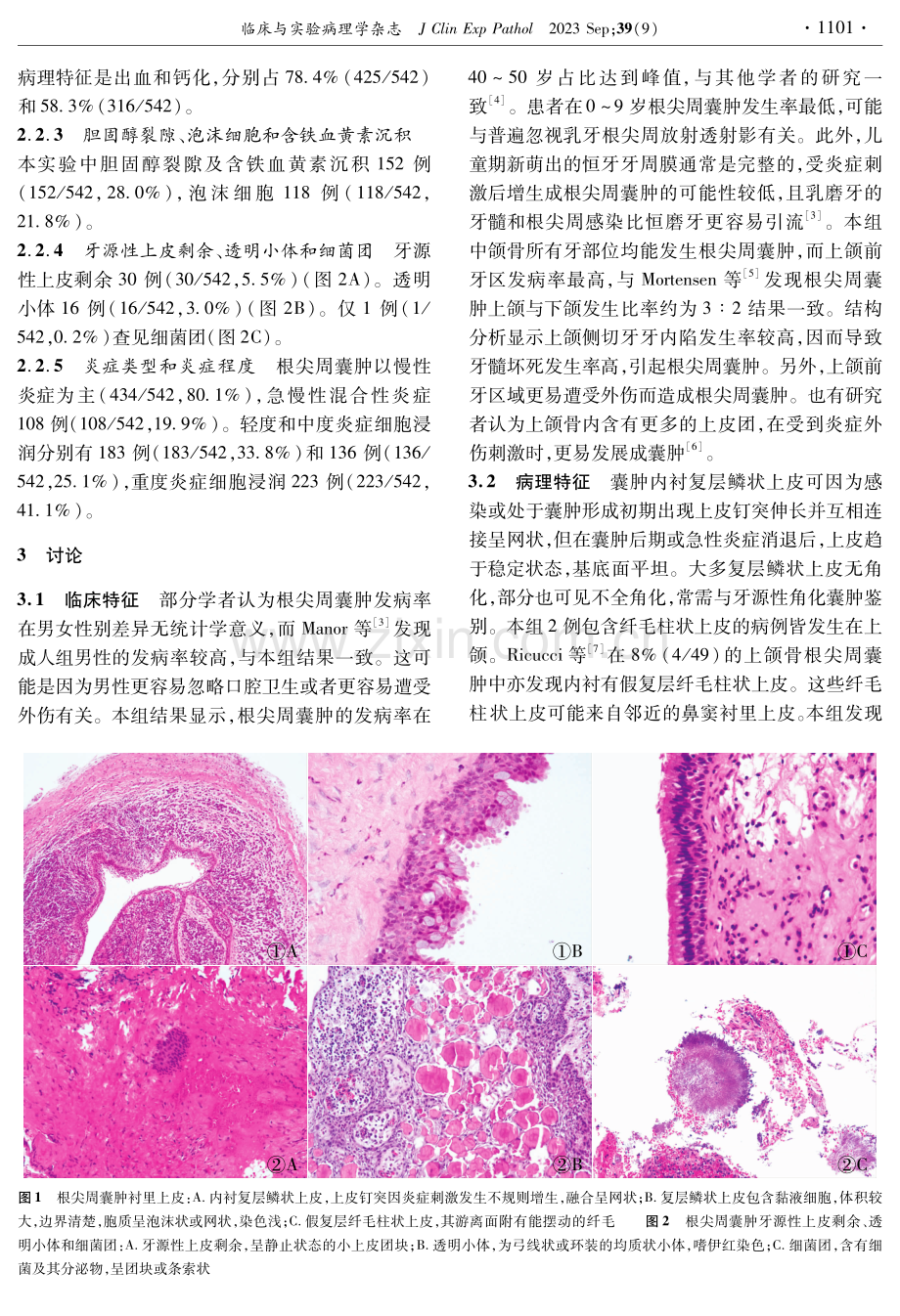 根尖周囊肿537例临床病理分析.pdf_第2页