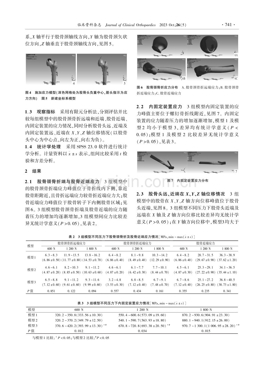 股骨颈动力交叉钉系统主钉位置对股骨颈骨折稳定性影响的有限元分析.pdf_第3页