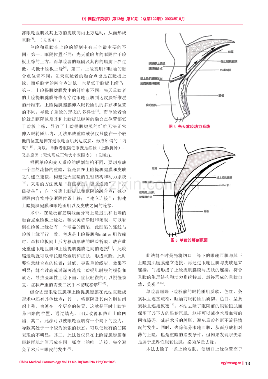 构建重睑生理结构和动力系统的重睑成形术.pdf_第3页