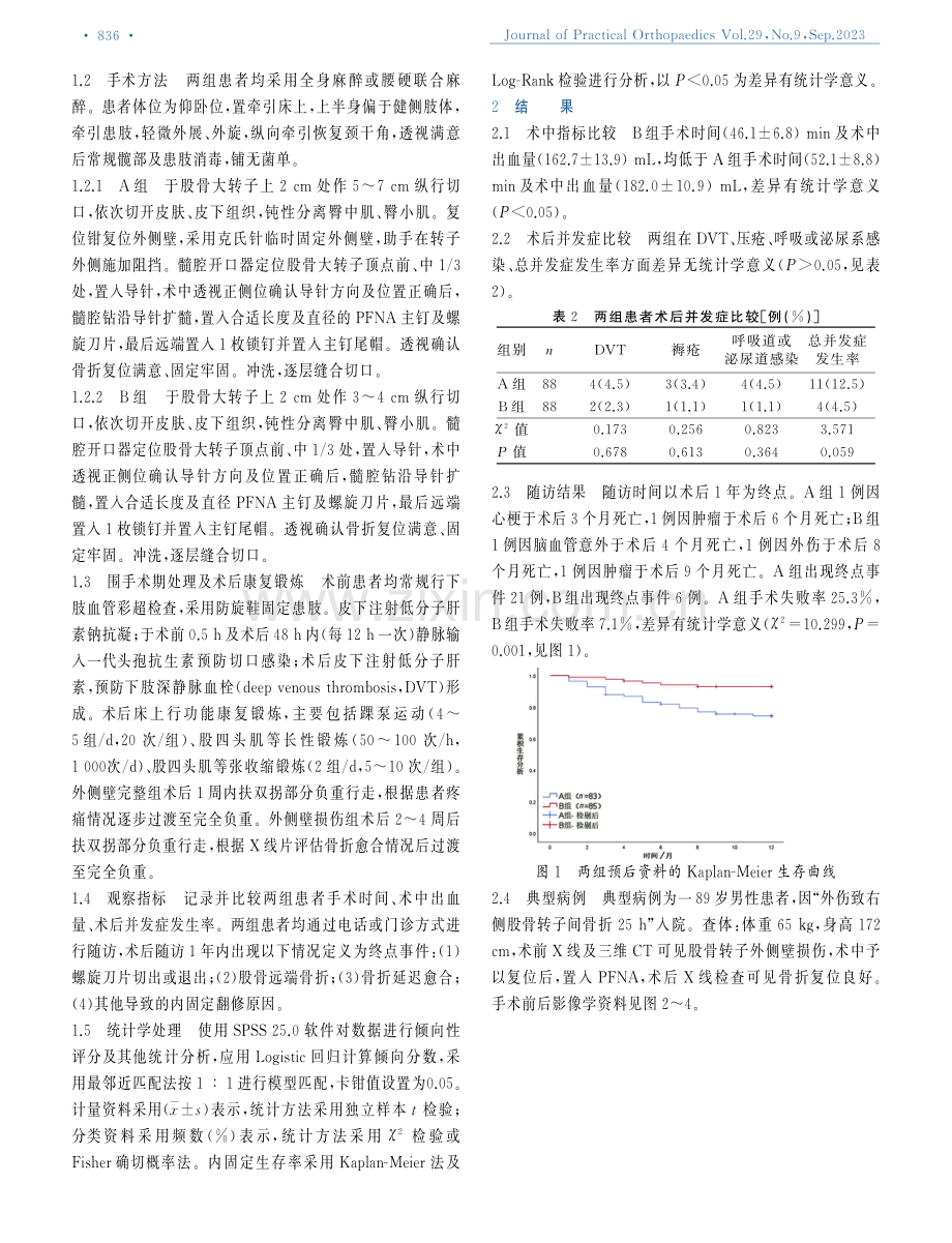 股骨近端防旋髓内钉治疗外侧壁损伤股骨转子间骨折.pdf_第2页