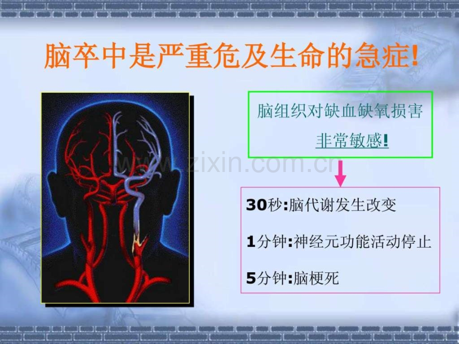 急性脑梗死静脉溶栓的护理查房9月.pptx_第3页