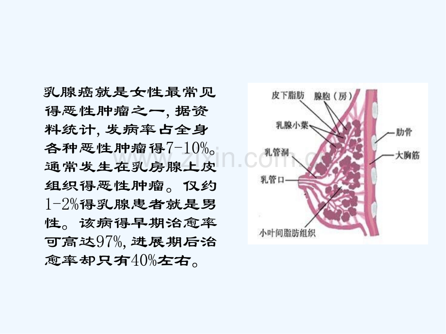 乳腺癌护理查房-(2)-PPT.pptx_第2页