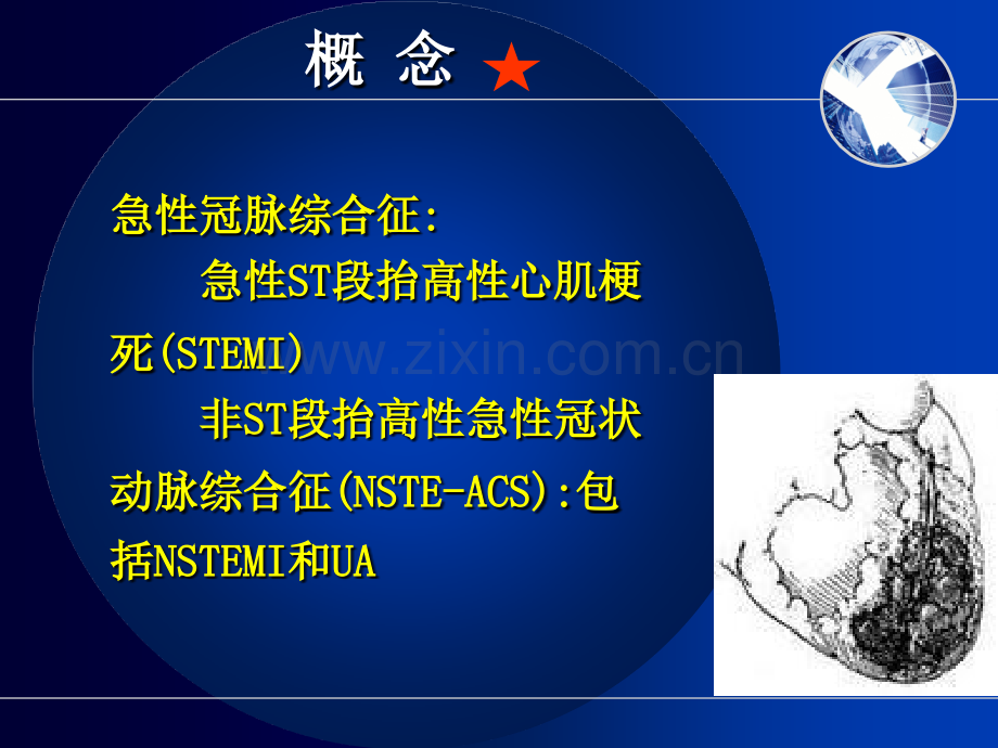 急性冠脉综合征规范化治疗.ppt_第2页