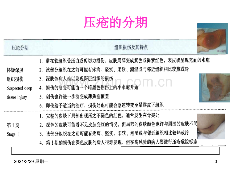 压疮伤口局部评估与护理记录指引.ppt_第3页