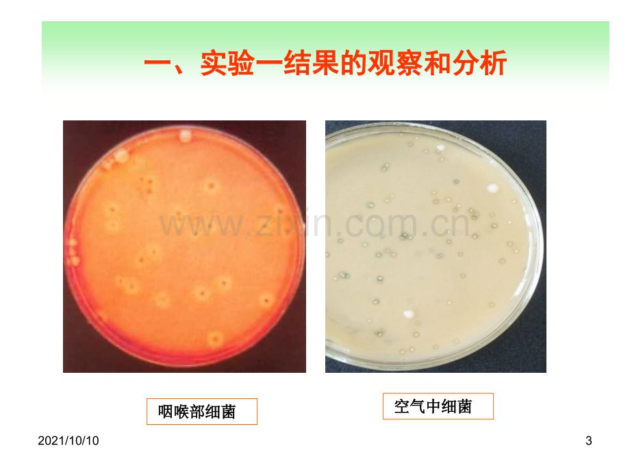 医学微生物学实验二抗酸染色.ppt_第3页