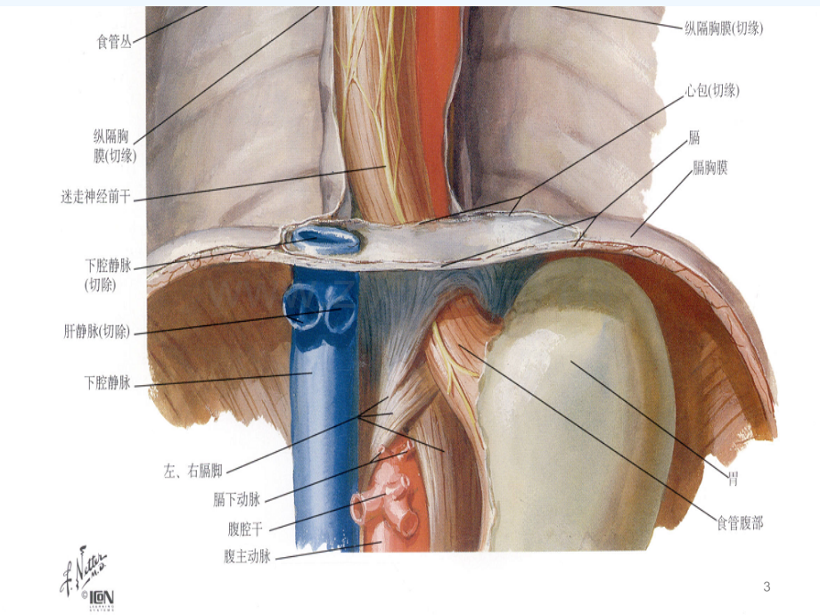 胃食管结合部腺癌及相关解剖-PPT.ppt_第3页