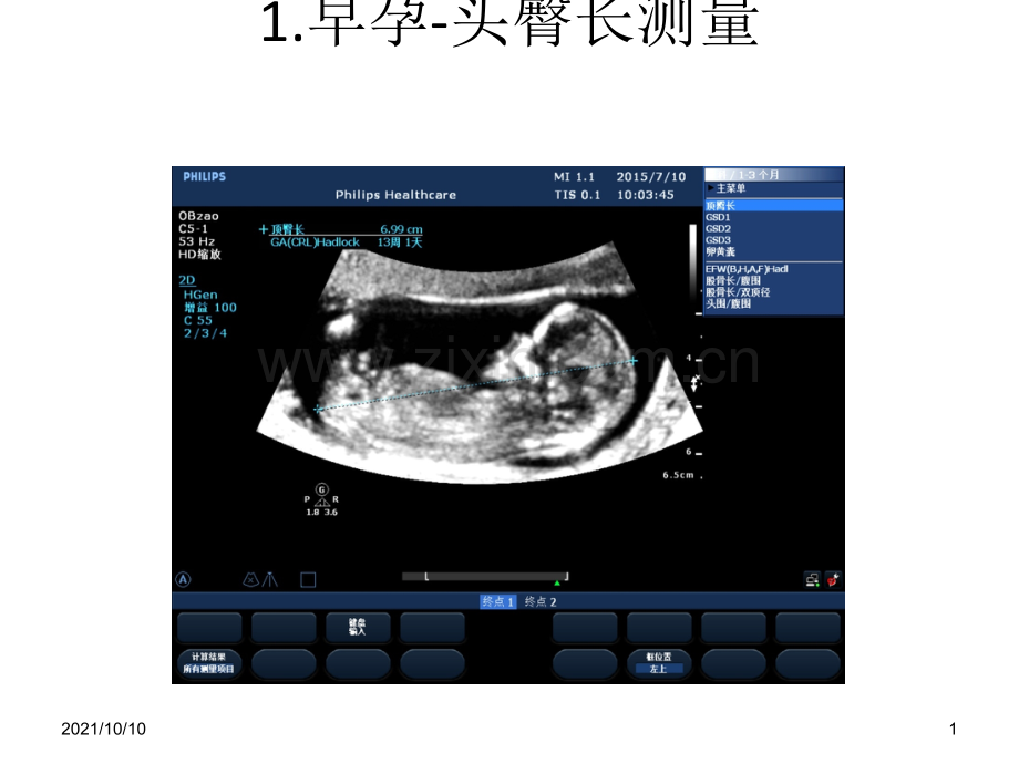 早中孕胎儿筛查标准切面.ppt_第1页