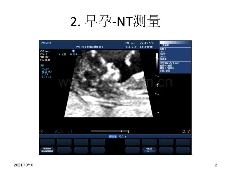 早中孕胎儿筛查标准切面.ppt_第2页