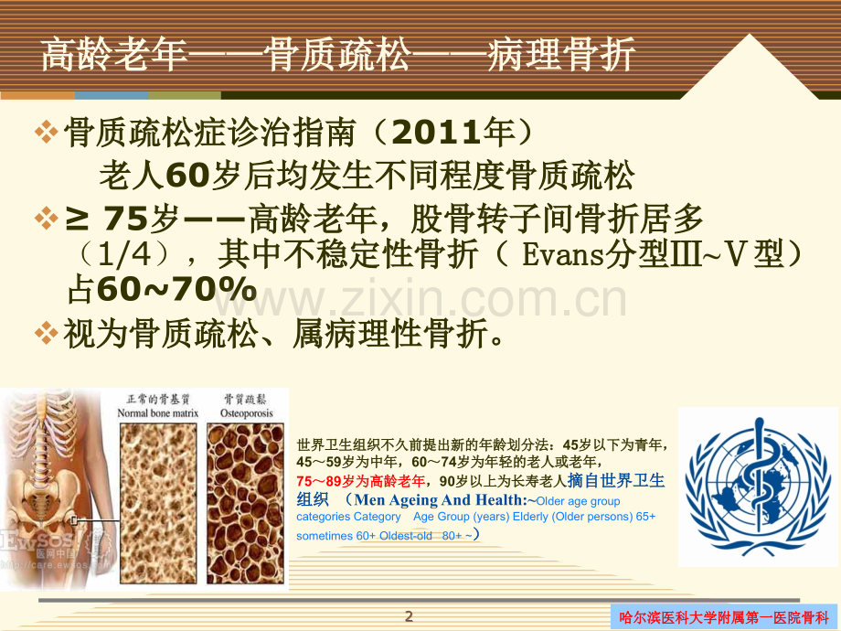 如何看待人工关节置换在高龄老年股骨转子间骨折治疗中的应用(2014).ppt_第2页