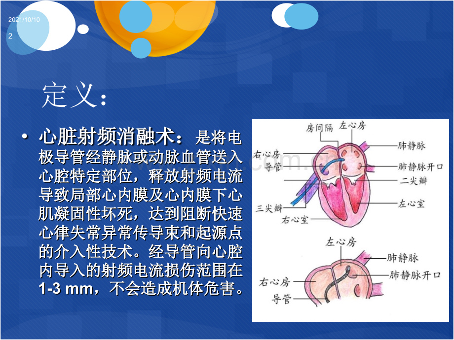 射频消融术术后护理.ppt_第2页