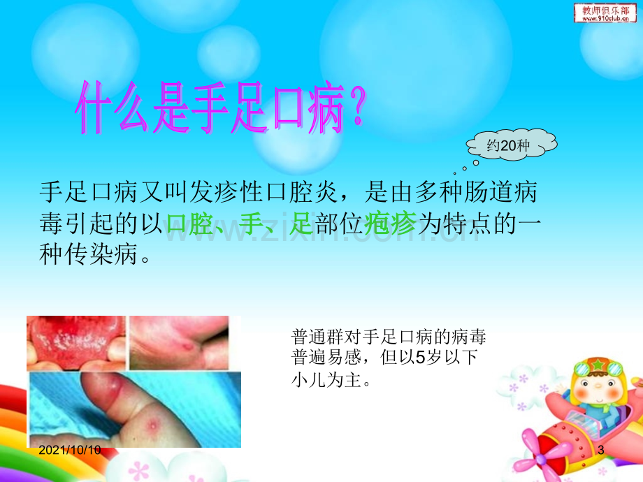 儿童常见传染病的预防.ppt_第3页