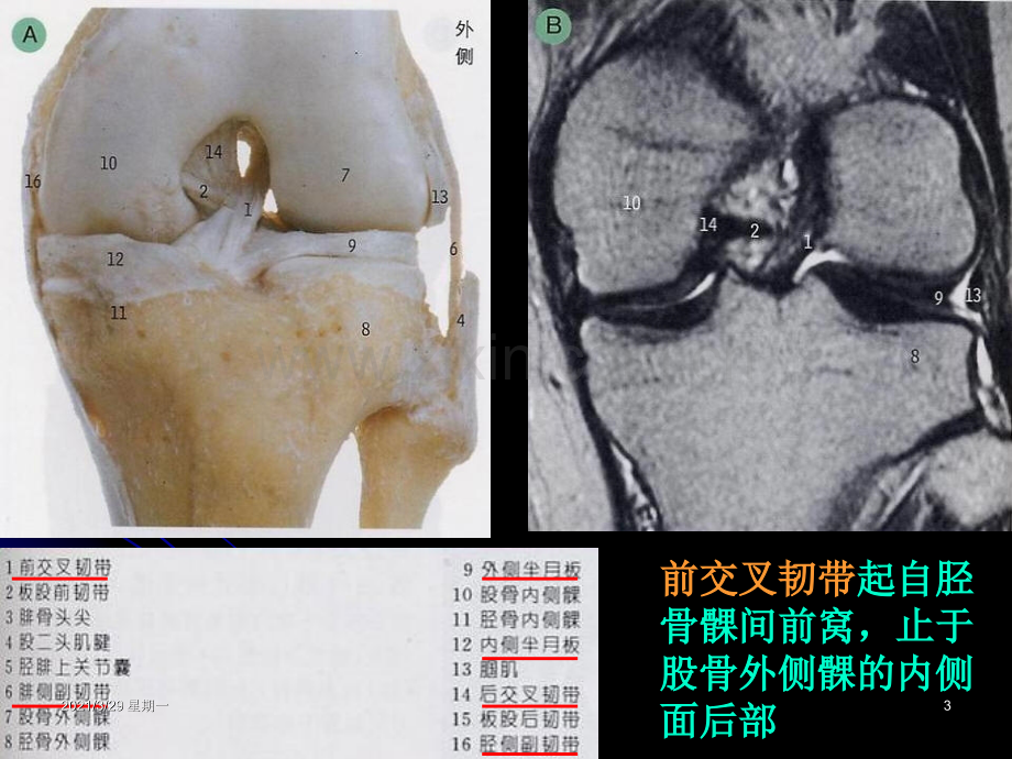 膝关节解剖及MRI诊断.ppt_第3页