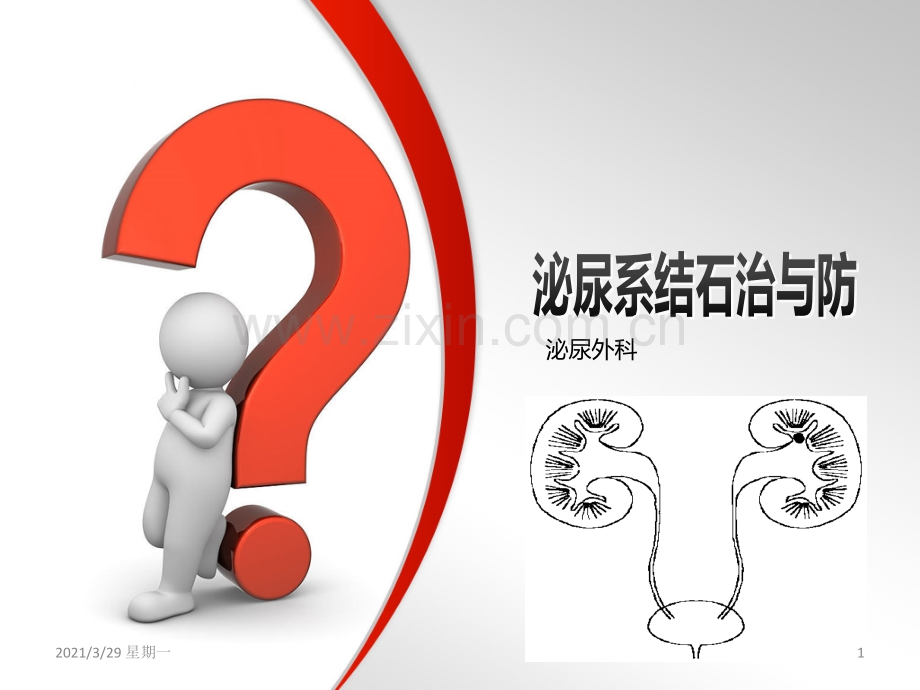 泌尿系结石健康教育.ppt_第1页