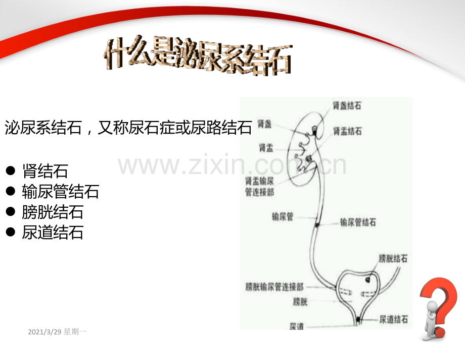 泌尿系结石健康教育.ppt_第3页