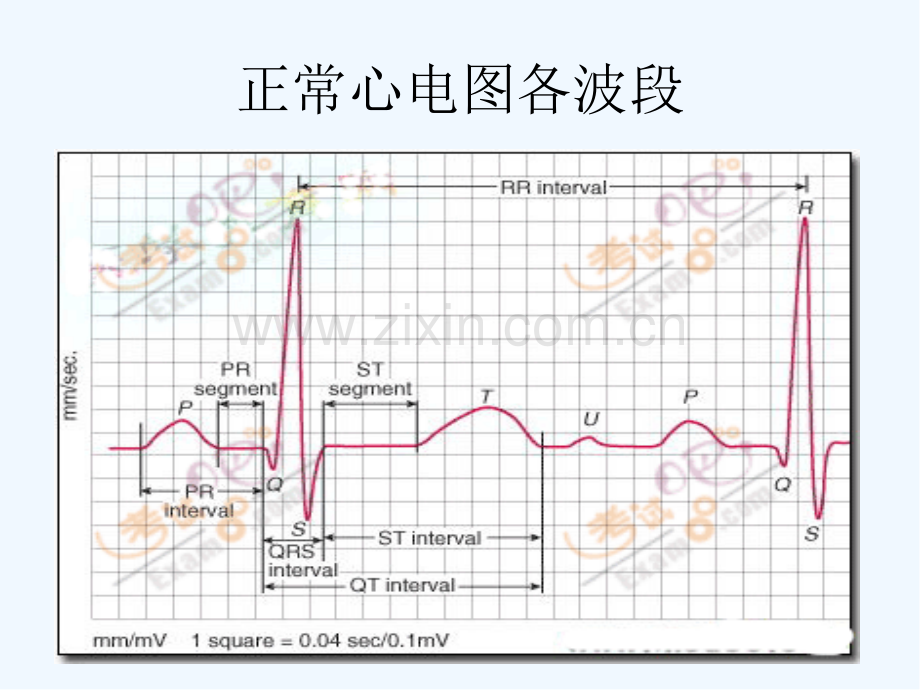 常见病心电图表现-PPT.pptx_第2页