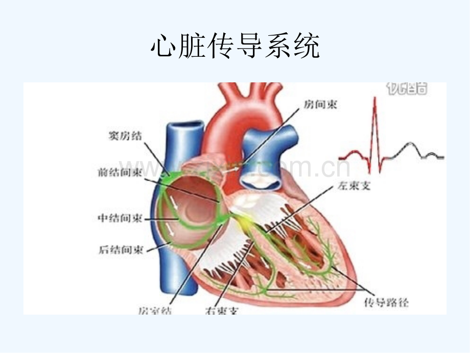 常见病心电图表现-PPT.pptx_第3页