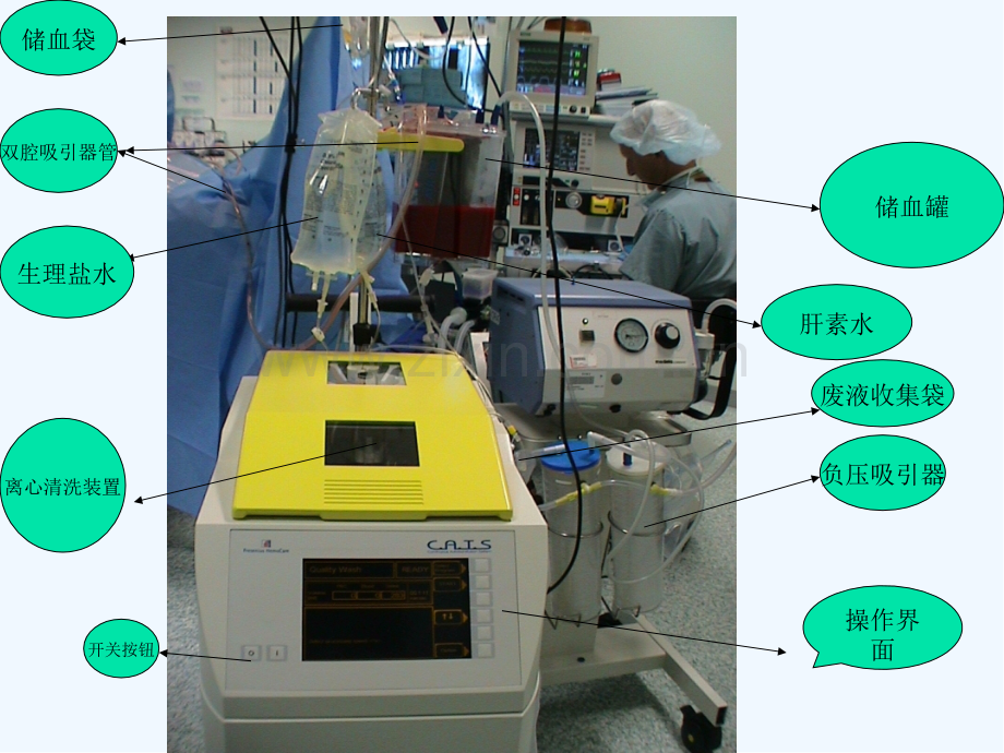 费森尤斯自体血回收机的使用及注意事项-PPT.pptx_第2页