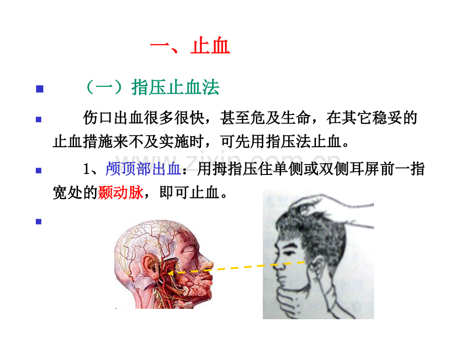 创伤现场急救的四项基本技术.ppt_第3页