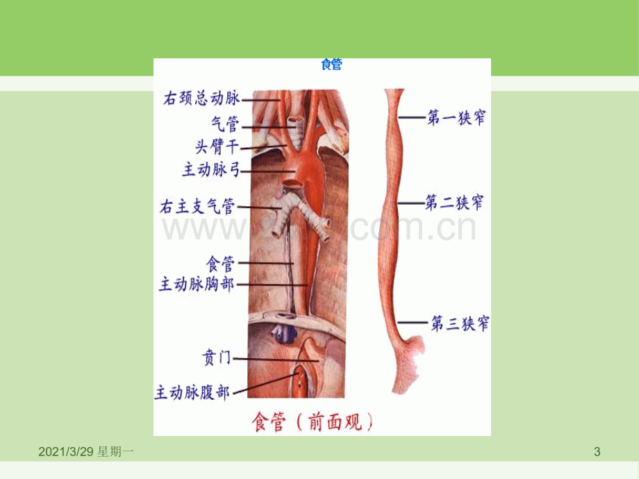 食道癌护理查房.ppt_第3页